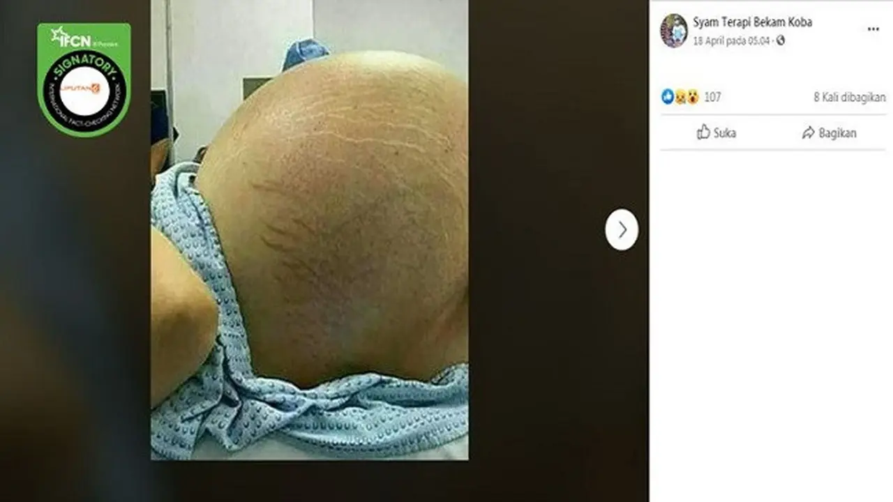 Gambar Tangkapan Layar Kabar Hoaks Tentang Kista dan Kanker Rahim