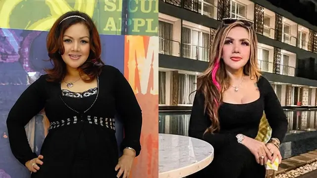 Beda Penampilan 9 Artis Sebelum vs Setelah Operasi Plastik, Bikin Pangling