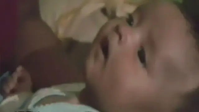 Bayi 3 Bulan Alami Gangguan Jantung Harus Dioperasi