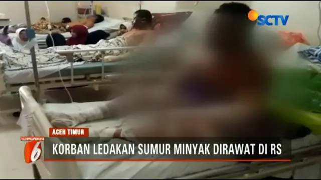 Lebih dari 40 orang korban ledakan sumur minyak di kawasan Perueulak, Aceh Timur, masih dirawat di sejumlah rumah sakit.