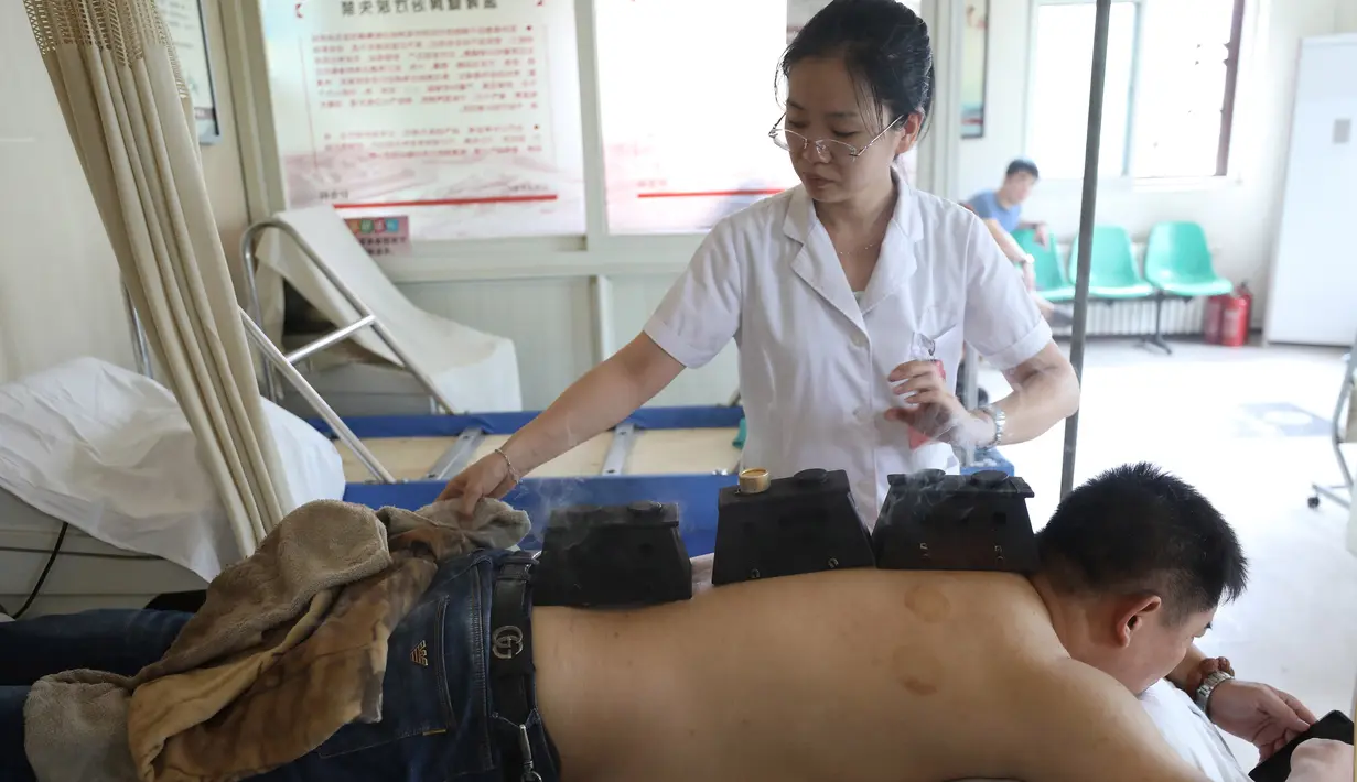 Pasien menerima pengobatan moksibusi di rumah sakit di Shenyang di provinsi Liaoning, China (7/8). Moksibusi menggunakan ramuan terbakar dengan kotak atau jarum pada titik akupuntur, digunakan untuk mengobati berbagai penyakit. (AFP Photo/Str/China Out)