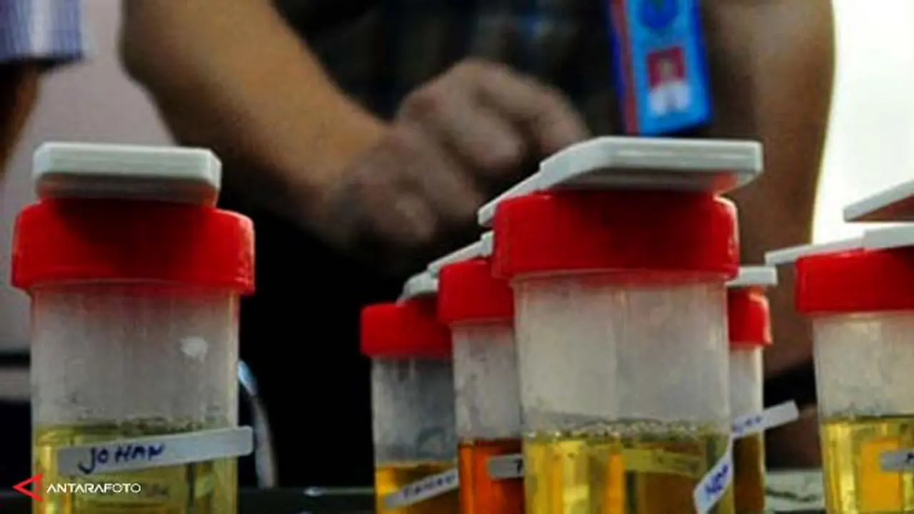 tes-urine-130630-b.jpg