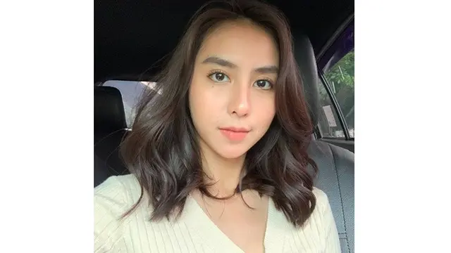 Akui Idap Kelainan Otak, Ini 6 Potret Terbaru Clairine Clay