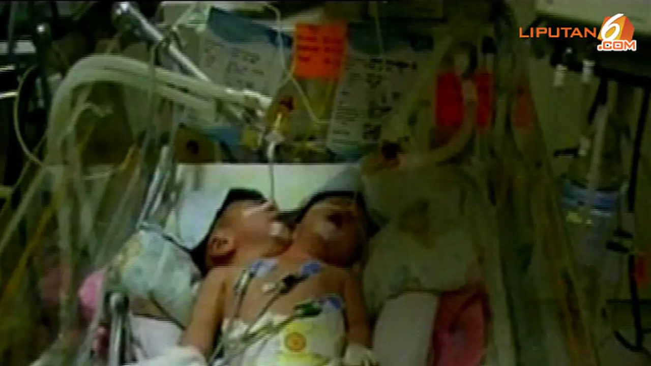 bayi-kepala2-130703d.jpg