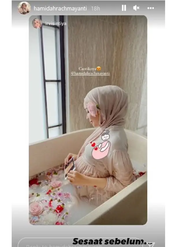 Kontraksi saat Maternity Shoot, Ini 6 Momen Persalinan Anak Kedua Istri Irvan Farhad