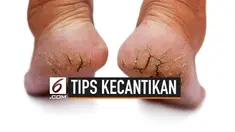 Kulit kaki yang kering bahkan pecah-pecah biasanya disebabkan oleh iritasi dan alergi. Masalah ini dapat diatasi di rumah dengan cara-cara berikut ini.
