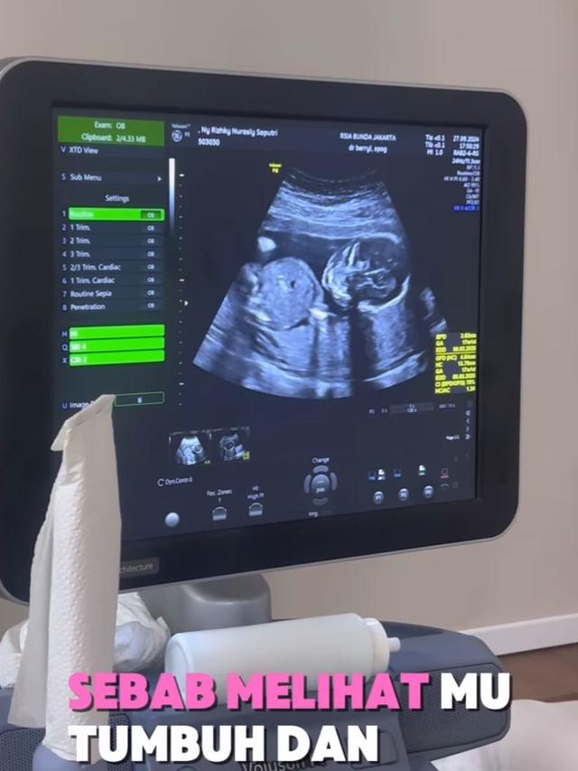 Kiky Saputri dan Muhammad Khairi mengumumkan kehamilan Kiky pada unggahannya (Instagram/@kikysaputrii dan @poykhairi)