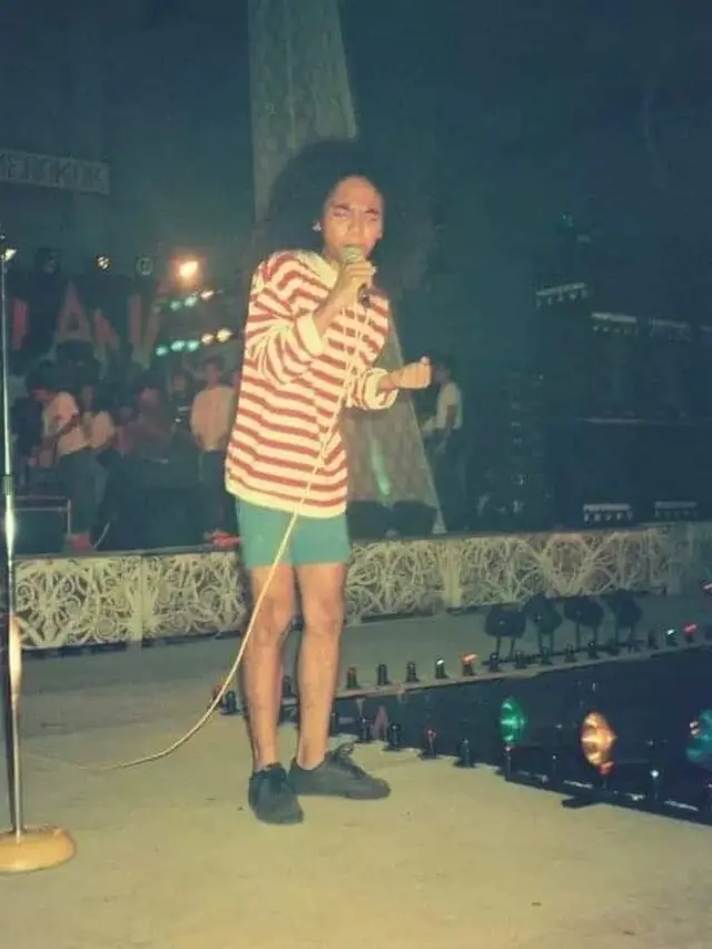 6 Transformasi Kaka Slank dari Penampilan Gimbal Hingga Kini Implan 5 Ribu Helai Rambut