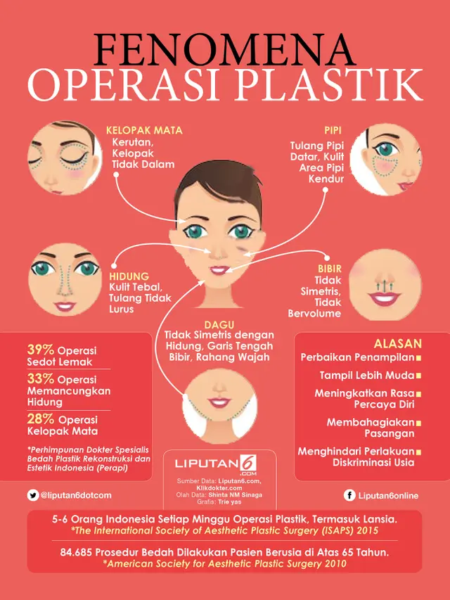 Infografis Fenomena Operasi Plastik