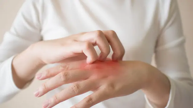 Telapak Tangan - Vania