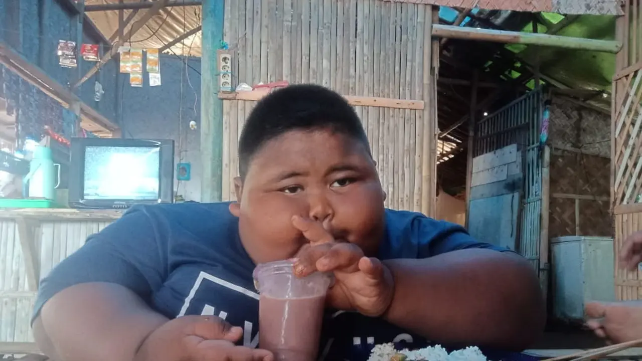 Satia, Bocah Obesitas Asal Karawang