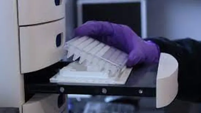 Teknologi Lab On a Chip