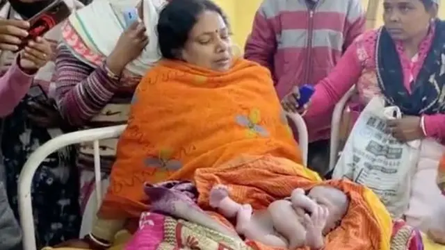 Viral Bayi Lahir dengan 4 Tangan dan 4 Kaki, Disebut Titisan Dewa