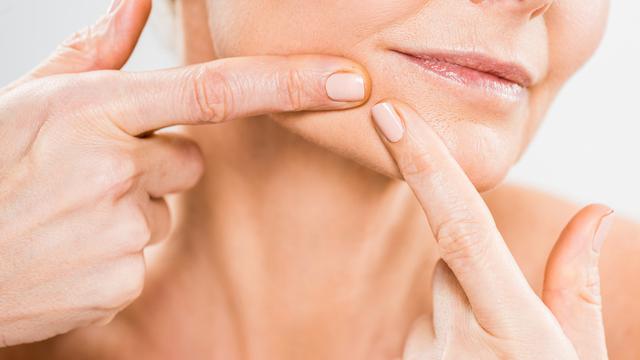 Kesalahan Saat Membersihkan Komedo