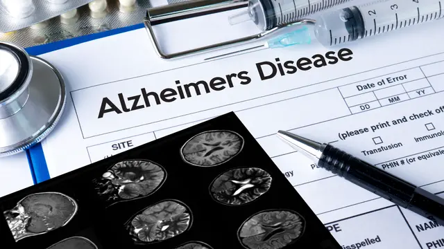 Penyakit Alzheimer
