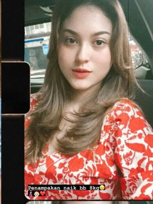 6 Potret Terbaru Marcella Daryanani Usai Menikah, Hamil Anak Pertama