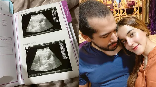 Tasya Farasya Alami Keguguran Anak Kedua, Ini Kondisinya Sekarang