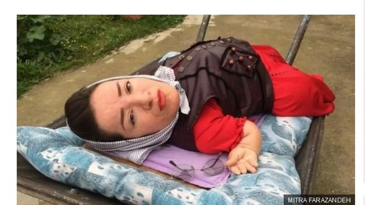 Kisah Cinta Mitra Farazandeh di Tengah Kondisinya Jadi Disabilitas