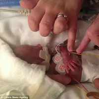 Saking kecilnya, lengan bayi ini bahkan bisa terselip cincin kawin ayahnya. 