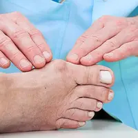 Ilustrasi Benjolan pada Jempol Kaki. (foto: Pinterest/psc).