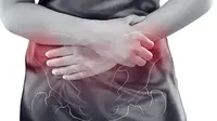 Pelvic Congestion Syndrome Featured. (Dok. Istimewa)