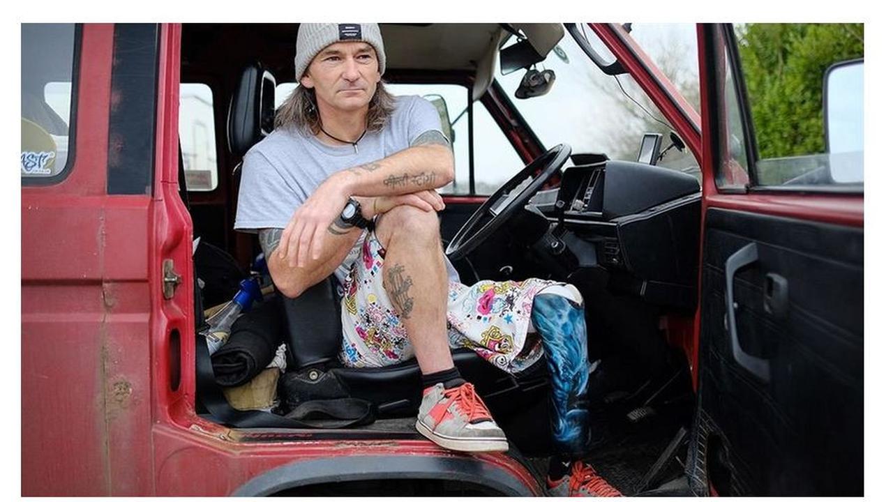 Rik Bennett atau Pagleg, pria asal Inggris yang merupakan disabilitas satu kaki dan memiliki hobi berselancar