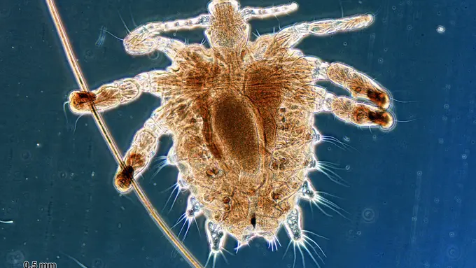 5 Cara Agar Kutu Gorila Tak Bersarang di Rambut Kemaluanmu