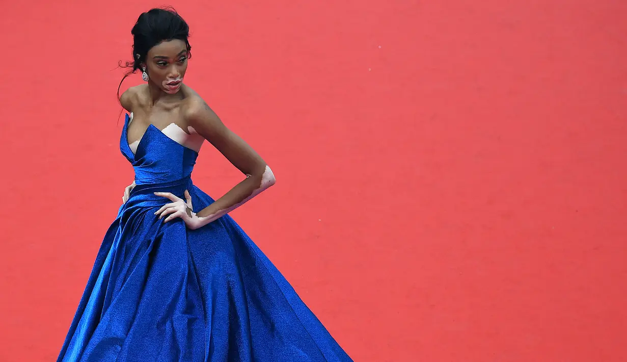 Model Kanada, Winnie Harlow berpose saat menghadiri pemutaran film 'Loveless' pada Festival Film Cannes ke-70 di Cannes, Prancis selatan. (AFP Photo/Antonin Thuillier)