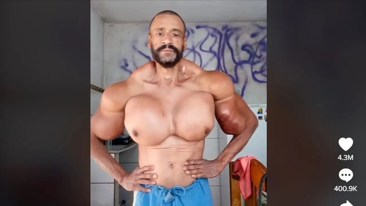 Hulk dari Brasil Meninggal, Kecanduan Zat Pembesar Otot Berbahaya Selama Bertahun-tahun