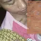 Foto: Tesiana Anur, bayi 10 bulan asal Mera, Desa Golo Tolang, Kecamatan Kota Komba, Kabupaten Manggarai Timur, NTT yang menderita tumor ganas (Liputan6.com/Dion)