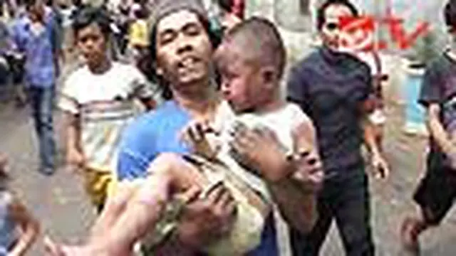 Dua Balita Mengalami Luka Bakar