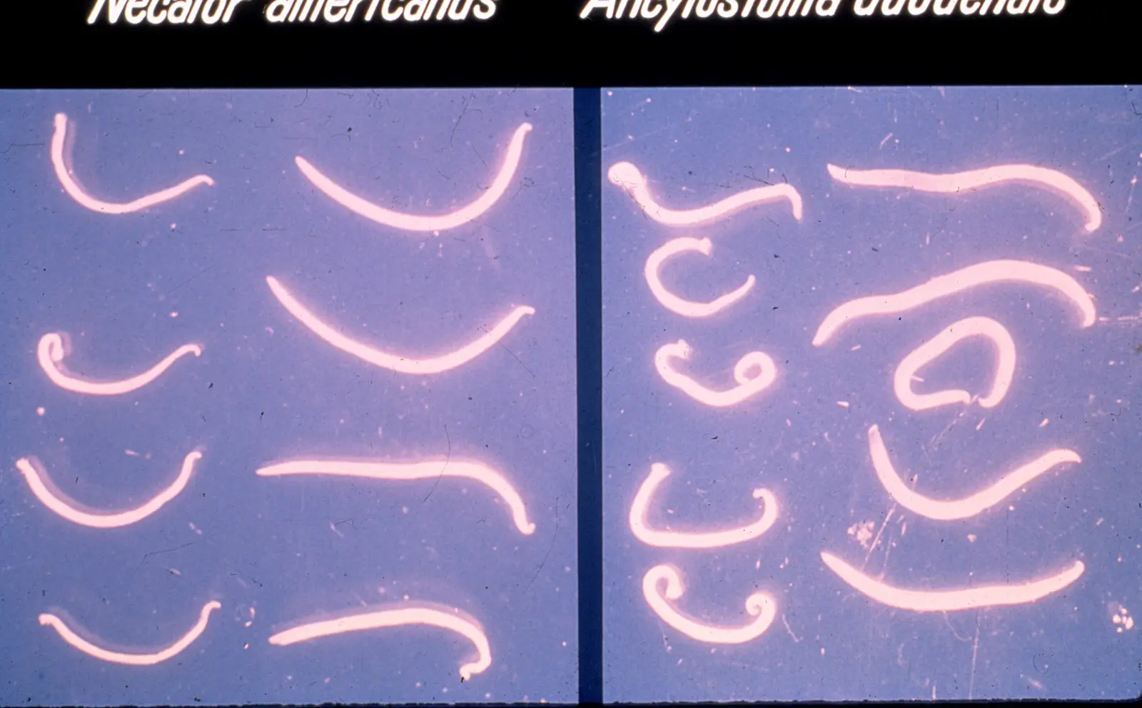 Terdapat dua jenis cacing tambang yakni Necator americanus (kiri) dan Ancylostoma duodenale 