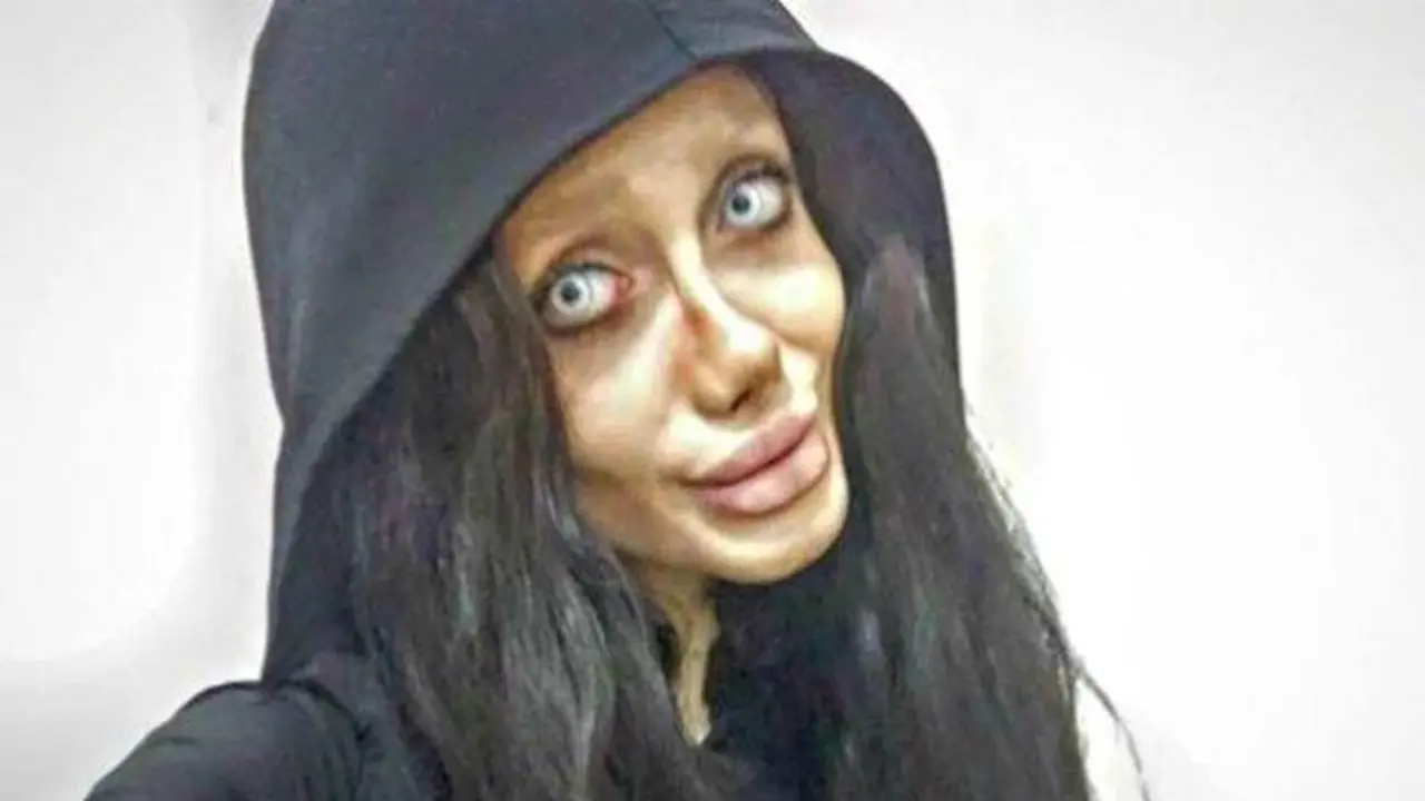 Gadis yang mengaku operasi plastik agar mirip Angelina Jolie ternyata palsu
