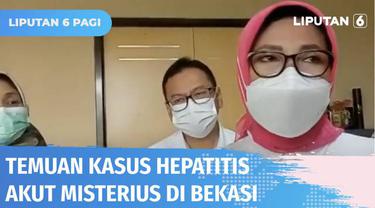 Pemerintah Kota Bekasi menginformasikan, seorang anak berusia 10 tahun diduga terjangkit penyakit hepatitis akut misterius. Sejauh ini Kemenkes mencatat ada 15 kasus hepatitis akut di Indonesia yang tersebar di lima provinsi.