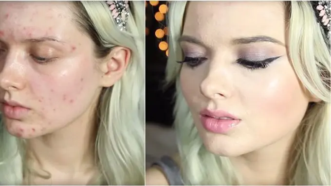 Foto: copyright goodhousekeeping.com/YouTube/My Pale Skin