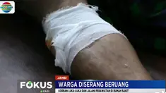 Pria berusia 29 tahun harus menjalani perawatan setelah menjadi korban keganasan empat ekor beruang liar pada Selasa pagi.