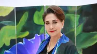 Widyawati Kerap Bikin Anak Khawatir, Ada Apa?