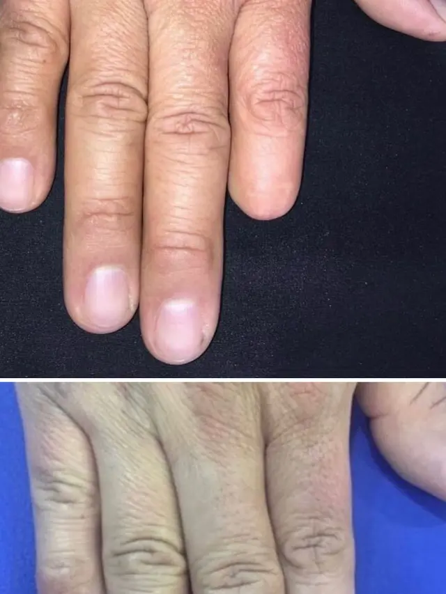 Gunakan Tato Untuk Menutupi Bekas Luka, 6 Potret Hasilnya Bikin Takjub. (Sumber: Boredpanda)
