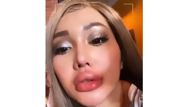 6 Selebriti Tanah Air yang Pernah Suntik Filler Bibir, Terbaru Lucinta Luna