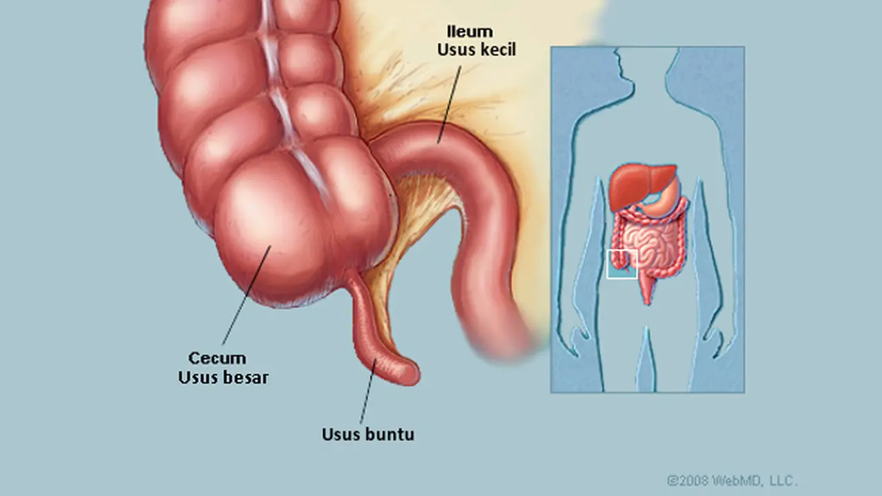 Usus buntu