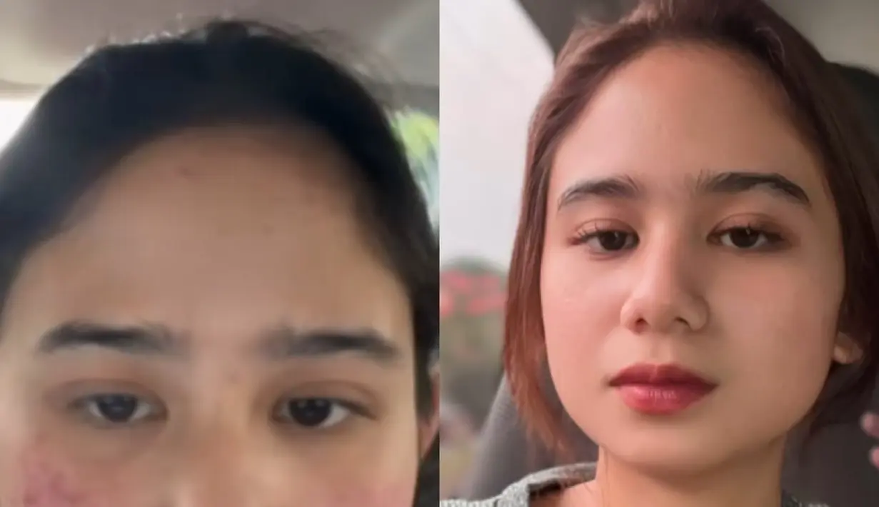 Tissa Biani mengunggah video singkat acne journeynya tepat si Hari Perempuan Internasional. Tissa mengenakan jaket abu-abu saat memerlihatkan wajahnya sudah bebas jerawat. [@tissabiani]