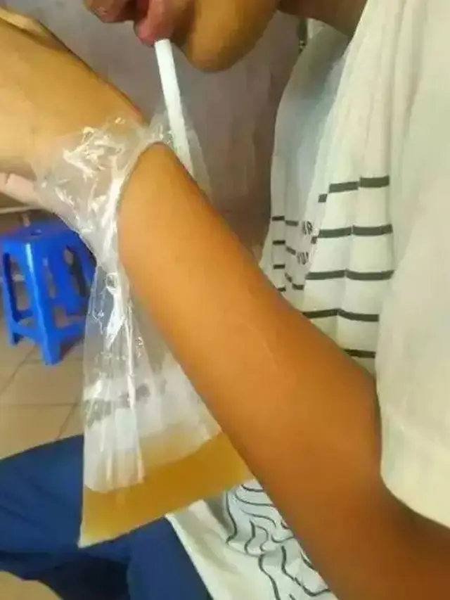 6 Potret Orang Minum Es dari Plastik Ini Bikin Tepuk Jidat, Ada Saja Idenya