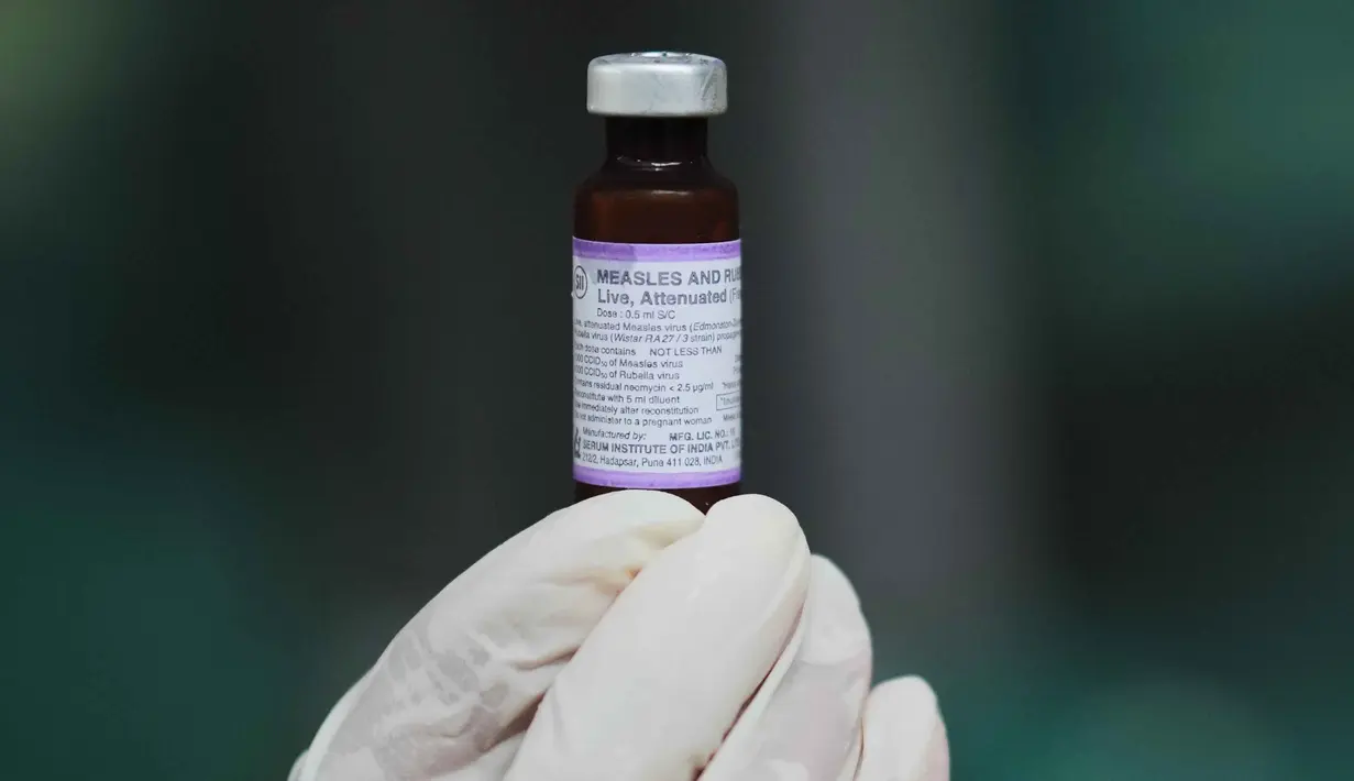 Untuk diketahui, Kabupaten Sumenep baru saja menetapkan kejadian luar biasa (KLB) campak dengan lebih dari dua ribu kasus suspek dan 17 anak meninggal dunia. (AP Photo/Dita Alangkara)