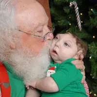Jaxon, bayi yang terlahir dengan tempurung kepala tak sempurna, akhirnya bisa bertemu dengan Santa!