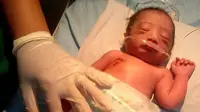Pada dada kanan sang bayi terdapat luka gores. (Liputan6.com/Reza Efendi)