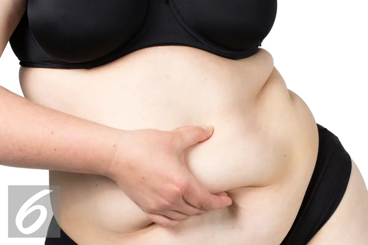 Ilustrasi Badan Gemuk atau Obesitas (iStockphoto)