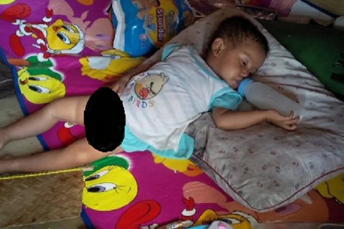 Bayi Diduga Pemakan Ular Butuh Bantuan
