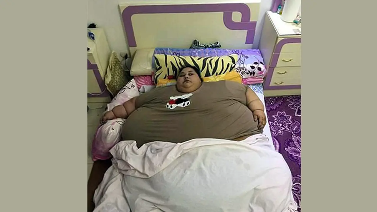 25 Tahun, Iman Tak Pernah Keluar Rumah Karena Terlalu Gemuk