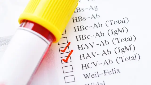 Penyebab Hepatitis (sumber: iStock)
