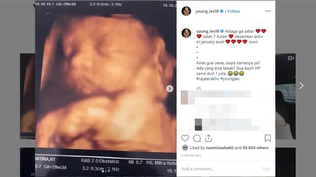 Tunggu Momongan, Ini Momen Syukuran 7 Bulanan Young Lex dan Eriska Keysha